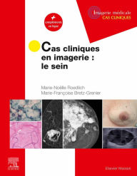 Title: Cas cliniques en imagerie : le sein, Author: Marie-Noëlle Roedlich