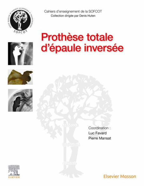 Prothèse totale d'épaule inversée