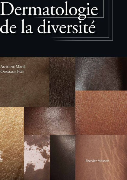 Dermatologie de la diversité