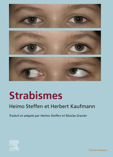 Strabisme