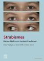 Strabisme