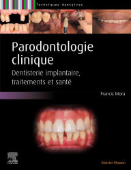 Title: Parodontologie clinique: Dentisterie implantaire, traitements et santé, Author: Francis Mora