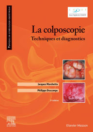 Title: La colposcopie: Techniques et diagnostics, Author: Jacques Marchetta