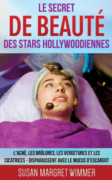 Le Secret de BeautÃ¯Â¿Â½ des Stars Hollywoodiennes: L'acnÃ¯Â¿Â½, les BrÃ¯Â¿Â½lures, les Vergetures et les Cicatrices - Disparaissent avec le mucus d'escargot