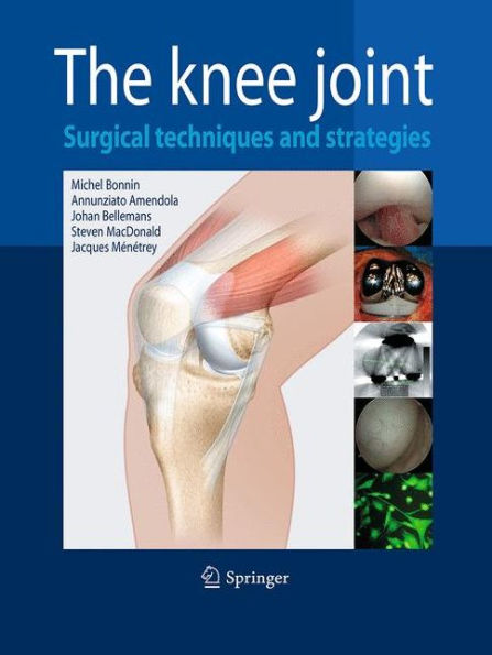 The Knee Joint: Surgical Techniques and Strategies