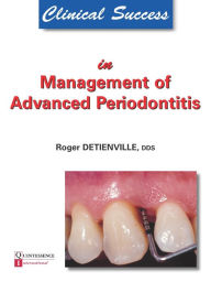 Title: Clinical Success in Management of Advanced Periodontitis, Author: Roger Detienville