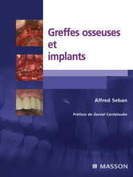 Title: Greffes osseuses et implants, Author: Alfred Seban