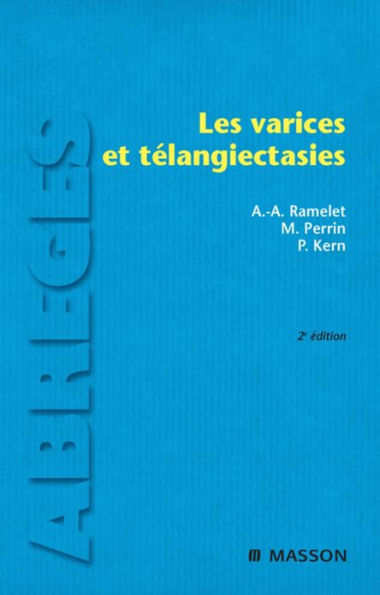 Les varices et télangiectasies