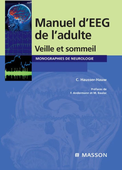 Manuel d'EEG de l'adulte: Veille et sommeil