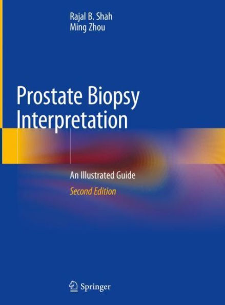 Prostate Biopsy Interpretation: An Illustrated Guide / Edition 2