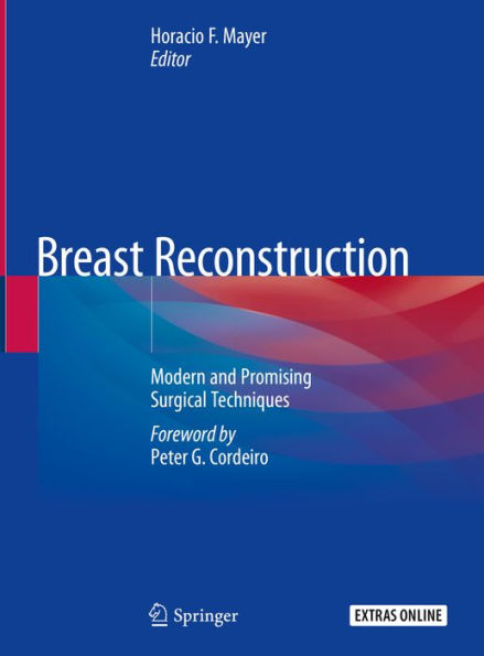 Breast Reconstruction: Modern and Promising Surgical Techniques
