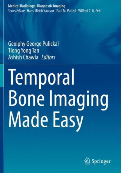 Temporal Bone Imaging Made Easy