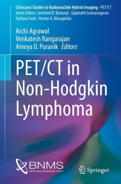 PET/CT Non-Hodgkin Lymphoma