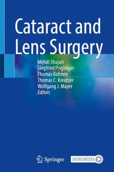 Cataract and Lens Surgery