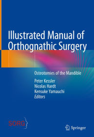 Title: Illustrated Manual of Orthognathic Surgery: Osteotomies of the Mandible, Author: Peter Kessler