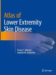 Books to download free for ipod Atlas of Lower Extremity Skin Disease (English literature)