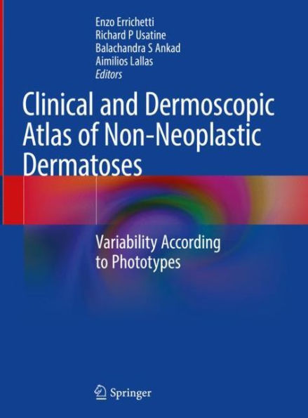 Clinical and Dermoscopic Atlas of Non-Neoplastic Dermatoses: Variability According to Phototypes