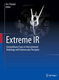 Free audiobook downloads computer Extreme IR: Extraordinary Cases in Interventional Radiology and Endovascular Therapies  9783031242502 by Ziv J Haskal, Ziv J Haskal (English literature)