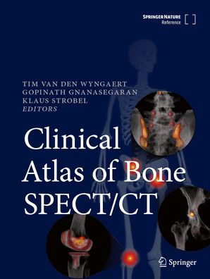 Clinical Atlas of Bone SPECT/CT