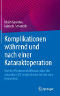 Komplikationen während und nach einer Kataraktoperation: Von der Phakoemulsifikation über die sekundäre IOL-Implantation bis hin zum Kernverlust