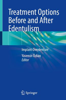 Treatment Options Before and After Edentulism: Implant Overdenture