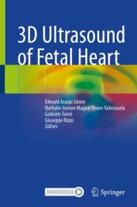 Download electronic books 3D Ultrasound of Fetal Heart (English Edition) PDB RTF ePub