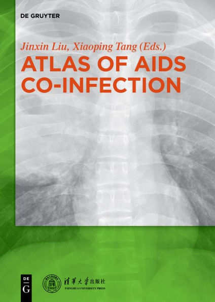 Atlas of AIDS Co-infection / Edition 1