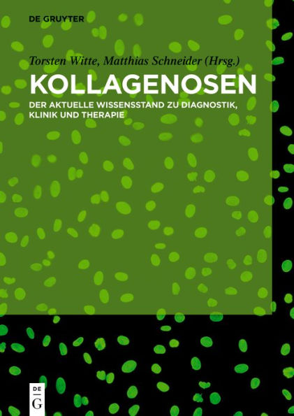 Kollagenosen: Der aktuelle Wissensstand zu Diagnostik, Klinik und Therapie