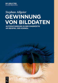 Title: Gewinnung von Bilddaten: Automatisierung in der Diagnostik am Beispiel der Kornea, Author: Stephan Allgeier