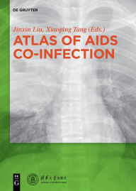 Title: Atlas of AIDS Co-infection, Author: Liu Jinxin