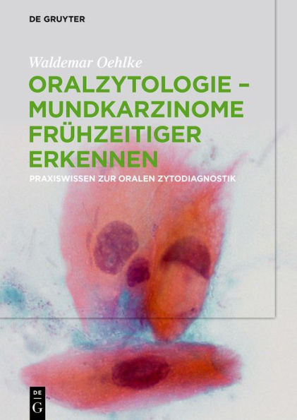 Oralzytologie - Mundkarzinome frühzeitiger erkennen: Praxiswissen zur Oralen Zytodiagnostik