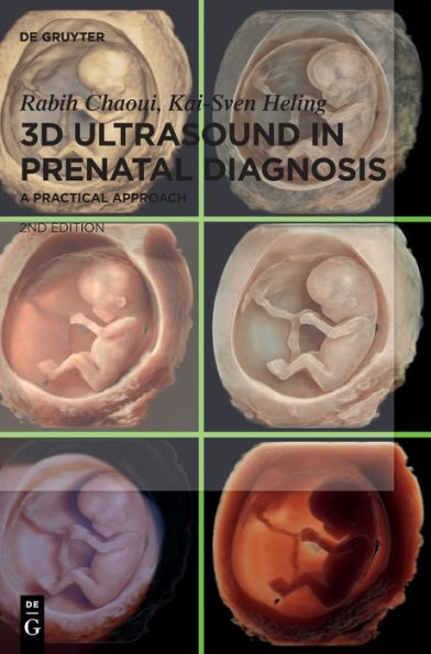 3D Ultrasound in Prenatal Diagnosis: A Practical Approach