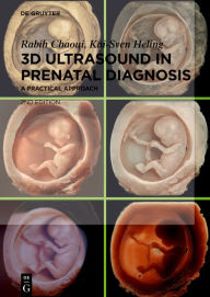 Title: 3D Ultrasound in Prenatal Diagnosis: A Practical Approach, Author: Rabih Chaoui