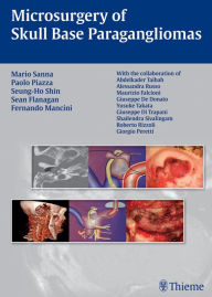 Title: Microsurgery of Skull Base Paragangliomas, Author: Mario Sanna