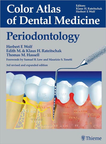 Color Atlas of Dental Medicine: Periodontology: Periodontology