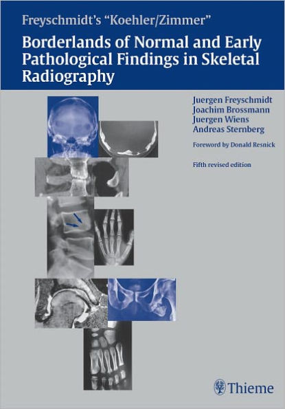 Freyschmidt's Koehler/Zimmer Borderlands of Normal and Early Pathological Findings in Skeletal Radiography