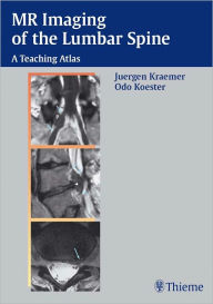 Title: MR Imaging of the Lumbar Spine: A Teaching Atlas, Author: Juergen Kraemer