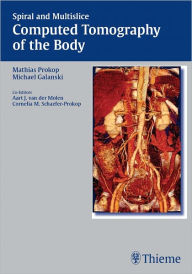 Title: Spiral and Multislice Computed Tomography of the Body, Author: Mathias Prokop