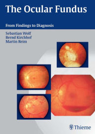 Title: The Ocular Fundus: From Findings to Diagnosis, Author: Sebastian Wolf