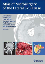 Title: Atlas of Microsurgery of the Lateral Skull Base, Author: Mario Sanna