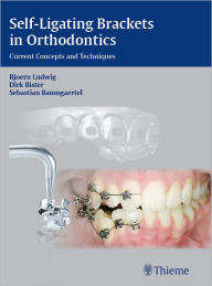 Title: Self-ligating Brackets in Orthodontics: Current Concepts and Techniques, Author: Bjoern Ludwig