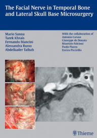 Title: Facial Nerve in Temporal Bone and Lateral Skull Base Microsurgery, Author: Mario Sanna