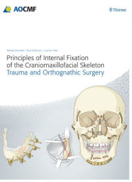 Title: Principles of Internal Fixation of the Craniomaxillofacial Skeleton, Author: Joachim Prein