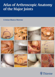 Download kindle books to ipad 3 Atlas of Arthroscopic Anatomy of Major Joints (English literature) PDF DJVU ePub by Cristian Blanco Moreno 9783132037915