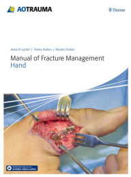 Read free online books no download Manual of Fracture Management - Hand 9783132215818 (English literature) by Jesse B. Jupiter iBook DJVU PDB