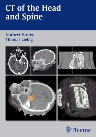 Title: CT of the Head and Spine, Author: Norbert Hosten
