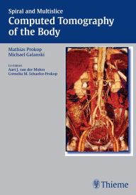 Title: Spiral and Multislice Computed Tomography of the Body, Author: Mathias Prokop