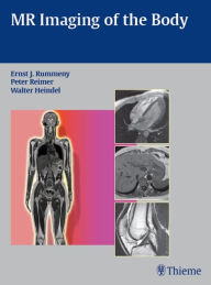 Title: MR Imaging of the Body, Author: Ernst Rummeny