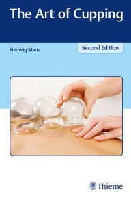 Title: The Art of Cupping, Author: Hedwig Manz