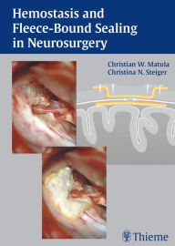 Title: Hemostasis and Fleece-Bound Sealing in Neurosurgery, Author: Christian Matula